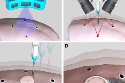 《Science》子刊：在活體器官上原位3D打印可變形水凝膠傳感器！