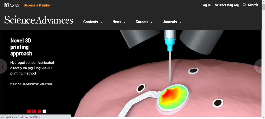 《Science》子刊：在活體器官上原位3D打印可變形水凝膠傳感器！