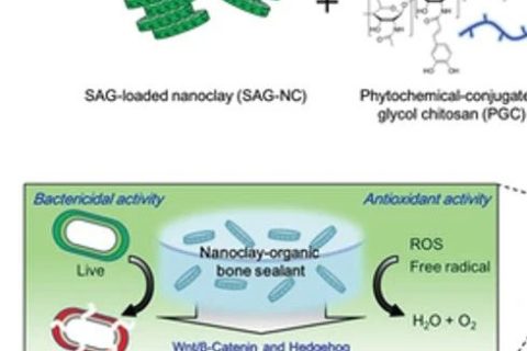 自然啟發(fā)的骨密封劑：多功能納米粘土有機水凝膠骨密封劑促進(jìn)骨再生