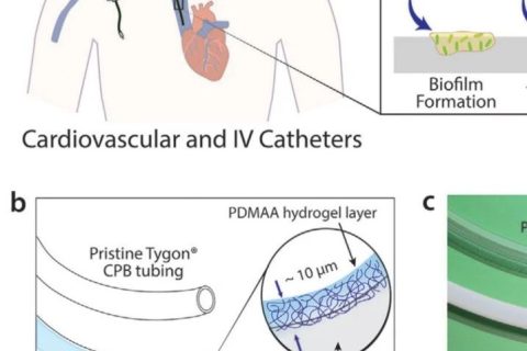 MIT趙選賀教授：超薄、耐用的水凝膠涂層：可同時減輕血栓和感染性并發(fā)癥